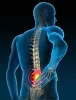 Most Effective Treatment For Back Pain