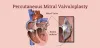 mitral valvuloplasty in india