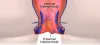 Gurgaon Piles Clinic - Gurugram Piles Clinic 