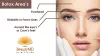 Botox specials west palm beach