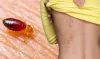 Bed Bug Control Services