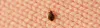 What Are Bed Bugs and What to do for bed bug control?