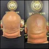 Scalp Micropigmentation Melbourne | SMP Clinic | Hair Tattoo Treatment