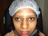 Affordable Squint Eye Treatment in Mumbai