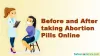 What Should you know Before using Abortion Pills - safeabortionrx blog