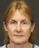 Best Facelift Surgeon In Seattle | Seattle Plastic Surgery