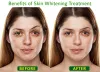 Skin Treatment in Gurgaon | Skin Doctor in Gurgaon | skin clinic