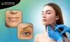 Belotero treatment New Jersey