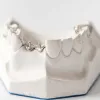 Tooth Replacement Options | Full Teeth Replacement Houston