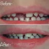 Best Pediatric Dentist Clinic in Dubai &amp; Abu Dhabi | Specialized For Kids