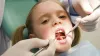 What Is Implant-Supported Dentures It’s Procedure?