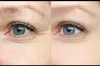 Skin Care Treatments in Dubai, Abu Dhabi &amp; Sharjah - Dynamic
