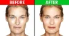 Amazing Tips to Reduce Wrinkles for Better Skin! - GeeksScan