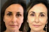 Unlocking the Power of Stem Cells in Dubai