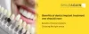 Smileagain: Benefits of dental implant treatment one should know