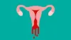 How Does The Use Of MTP Kit Influence My Period?
