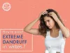 Top 10 Dermatologists in Delhi | Best Dermatologist In Delhi For Skin