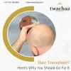 best hair transplant clinic in faridabad