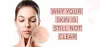 Skin Tips - Why Your Skin is Still not Clear | Nature's Island