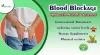 How Identify and Treat Blood Blockage Before it Turn to Dangerous