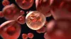 Types of Blood Cancer
