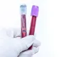 Blood Collection market