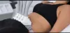 Things to Consider When Hiring an Experienced Body Contouring Specialist 