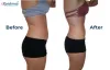 #1 Best Body Contouring/Reshaping Clinic in Durgapur