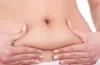 Does Liposuction Remove Fat Forever?
