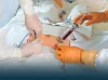 Bone Marrow Transplant: Procedure and Cost - Teachforhk