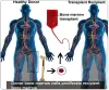 Types of Bone Marrow Transplant