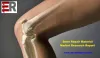 Global Bone Repair Material Market Status, Industry Overview, Trends and Outlook 2014 – 2024