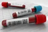 Book Blood Tests At Home Nagpur
