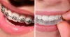 Top 10 Orthodontist in Delhi