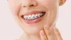 braces treatment
