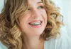 Lingual Braces Colorado Springs