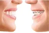 Best Orthodontist, Dental Braces Treatment in Delhi, Braces Orthodontic Services in South Delhi, Greater Kailash