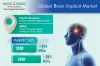 Increasing Prevalence of Neurological Diseases Propelling Brain Implants Demand