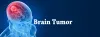 Best Brain Tumor Surgery Hospital in Gurgaon