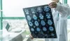 Brain Injuries - Injuredcare