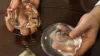 What Does Breast Implant Rippling Look Like? - Dr Adnan Tahir