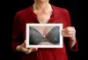Breast augmentation Cape Town