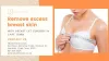 Reshape your breast using breast lift surgery in Cape Town