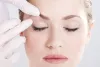Brow Lift Surgery 