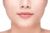 Buccal Fat Removal Procedure