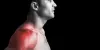 Bursitis/ Rotator Cuff Tendinitis: Causes, Symptoms & Treatment