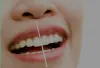 My London Dentist — Teeth Whitening & Teeth Whitening Kits |...