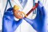 Things to Know About the KFT or Kidney Function Test - JustPaste.it
