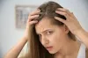 TREATMENTS AVAILABLE FOR MEN SUFFERING FROM HAIR LOSS
