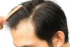 Can I get the Best Hair Specialist in Lahore? – Updates Health
